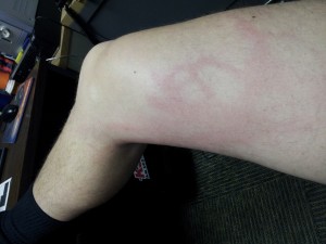 Leg